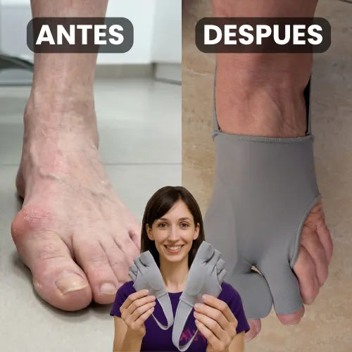 Corrector de Juanetes FixPro™