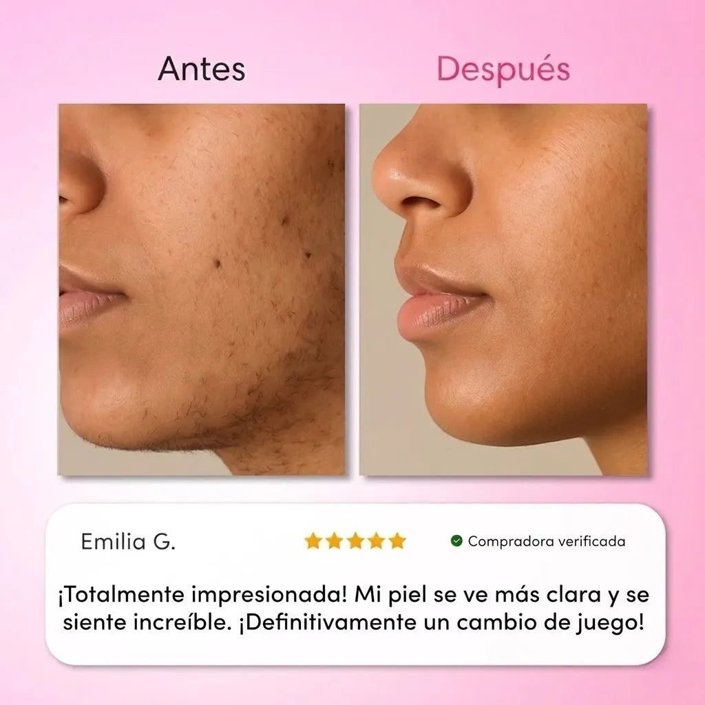 Kit Depilación Facial