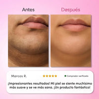 Kit Depilación Facial