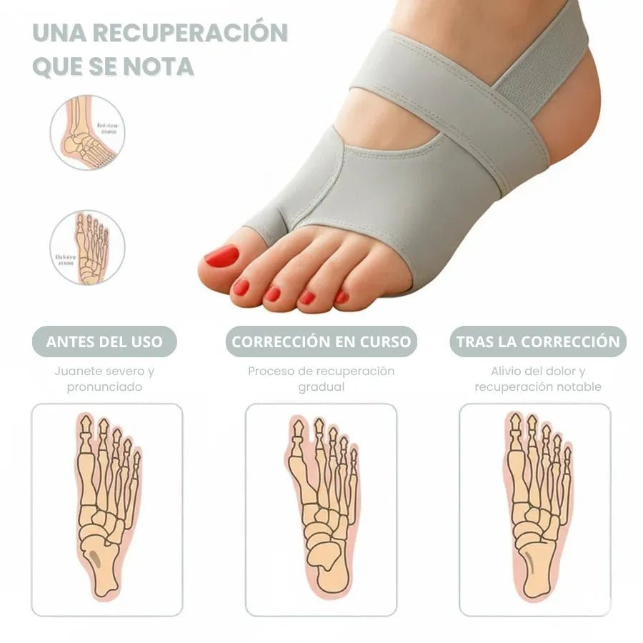 Corrector de juanetes con almohadilla protectora y separador de dedos para hallux valgus